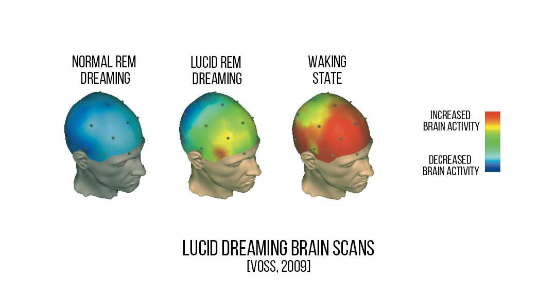 lucid-dreamer-the-most-advanced-lucid-dream-device