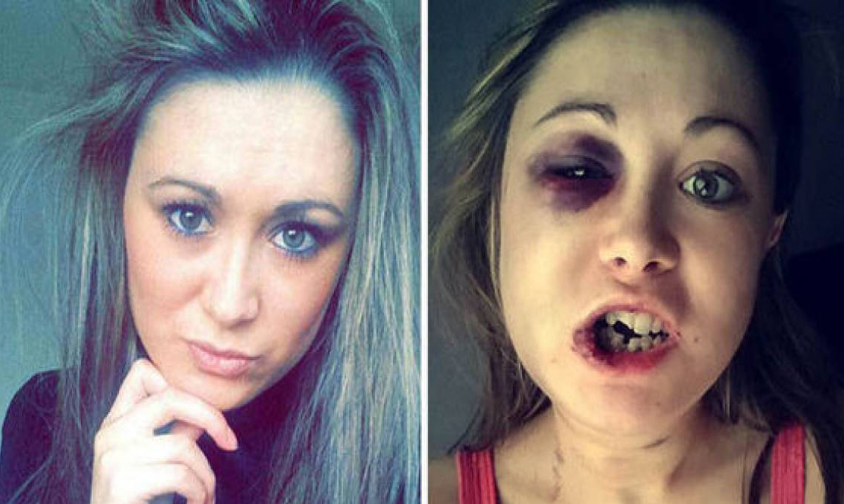 Woman Sheds Light on Abuse, Posts Graphic Photos After Boyfriend Beat Her for “Not Wanting Sex”