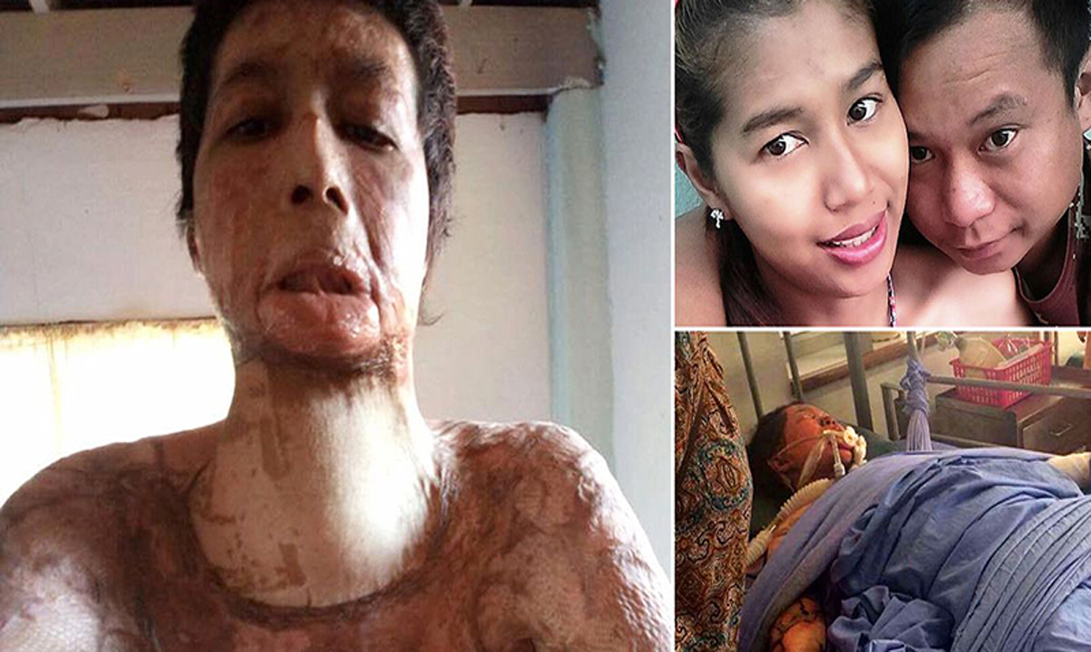 Woman Doused in Gasoline, Set on Fire By Own Husband After Posting Three Selfies on Facebook